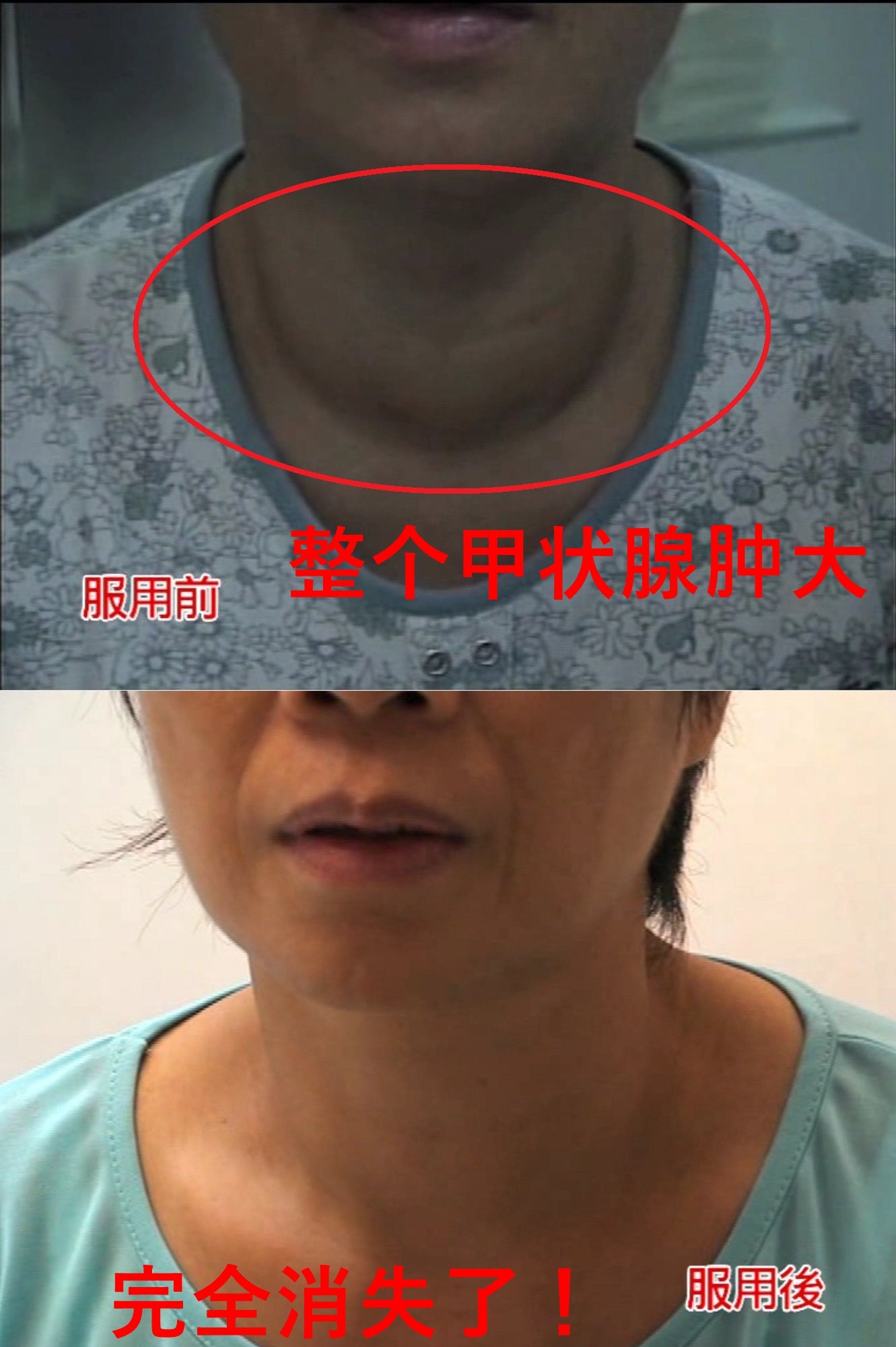 甲通康 6 盒