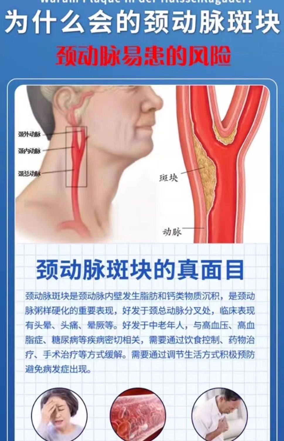 動脈斑塊貼