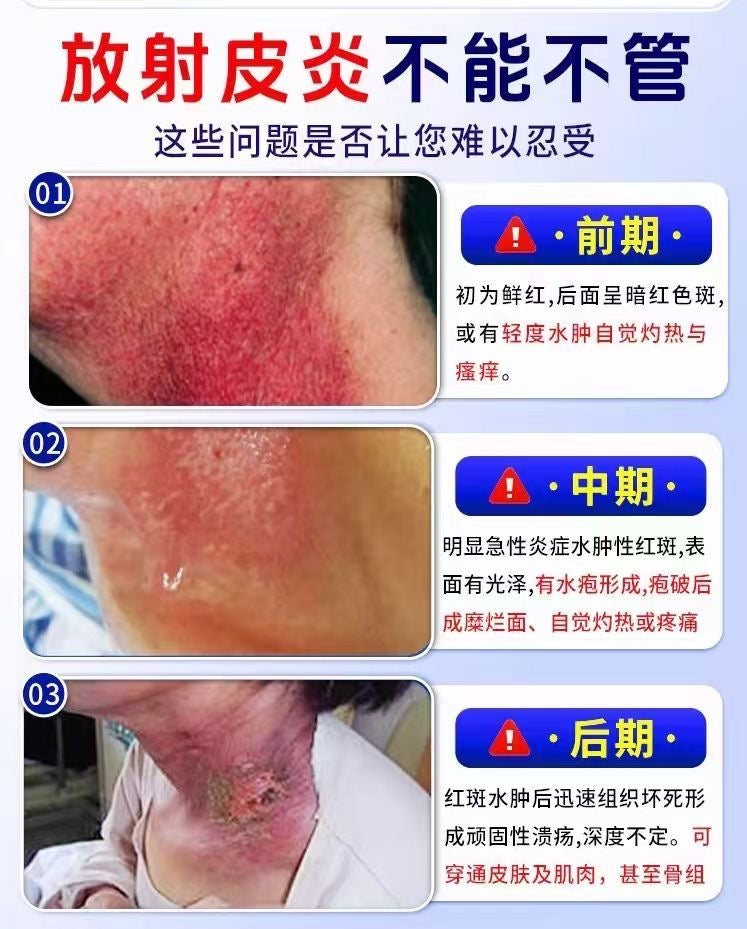 放療後皮膚修復